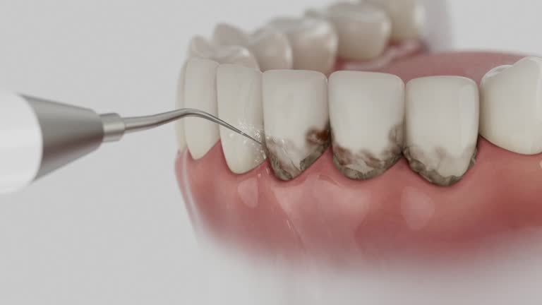 Reliable Dental Implants contractor in Spring Valley, WI by Smile Center Dentistry